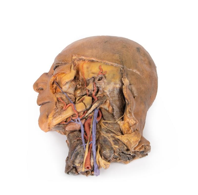 Erler-Zimmer 3D Printed Sagittal Section of Head and Neck with