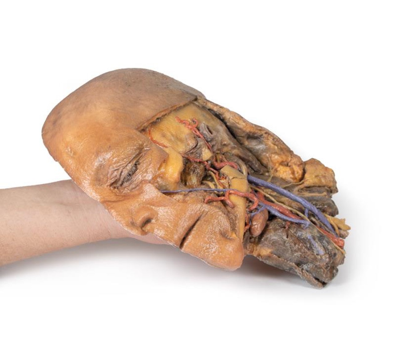 3D Printed Sagittal Section of Head and Neck with Infratemporal Fossa and Carotid Sheath Dissection