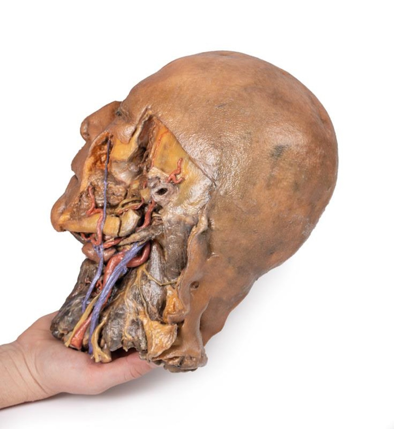 3D Printed Sagittal Section of Head and Neck with Infratemporal Fossa and Carotid Sheath Dissection