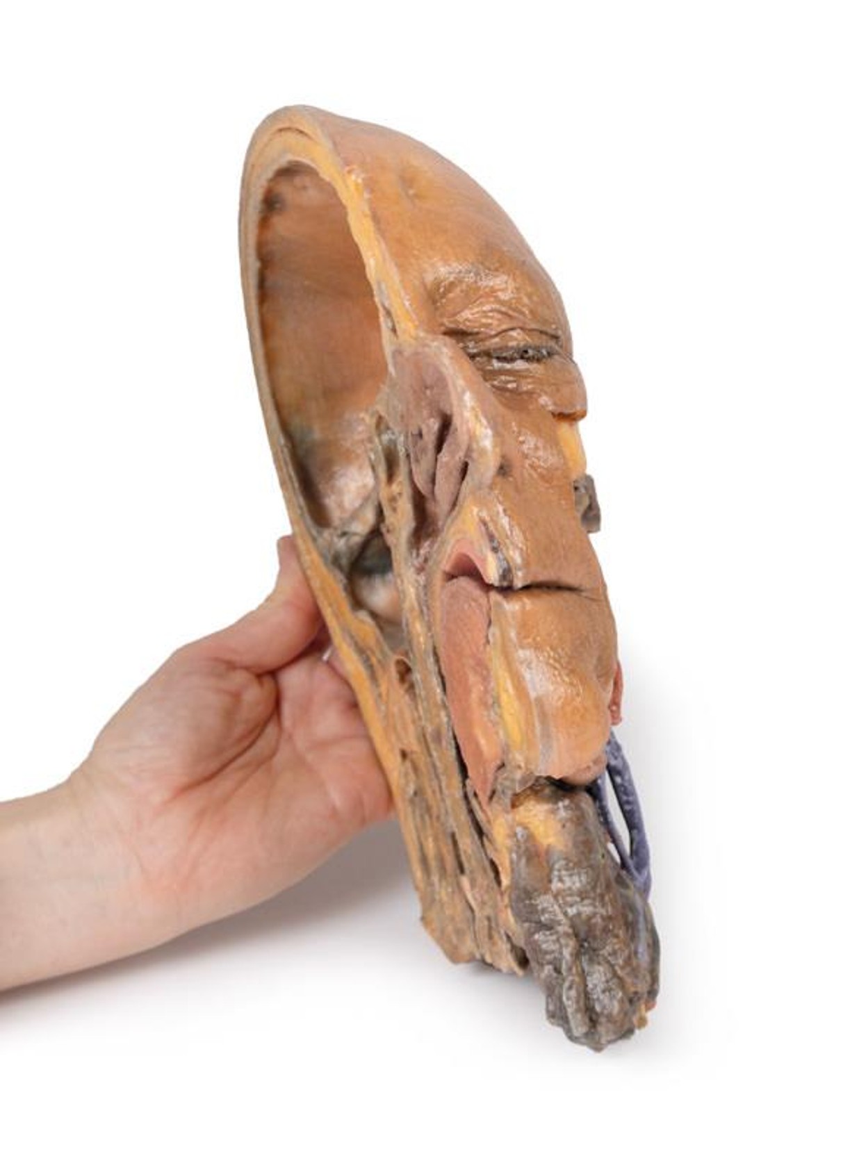3D Printed Sagittal Section of Head and Neck with Infratemporal Fossa and Carotid Sheath Dissection
