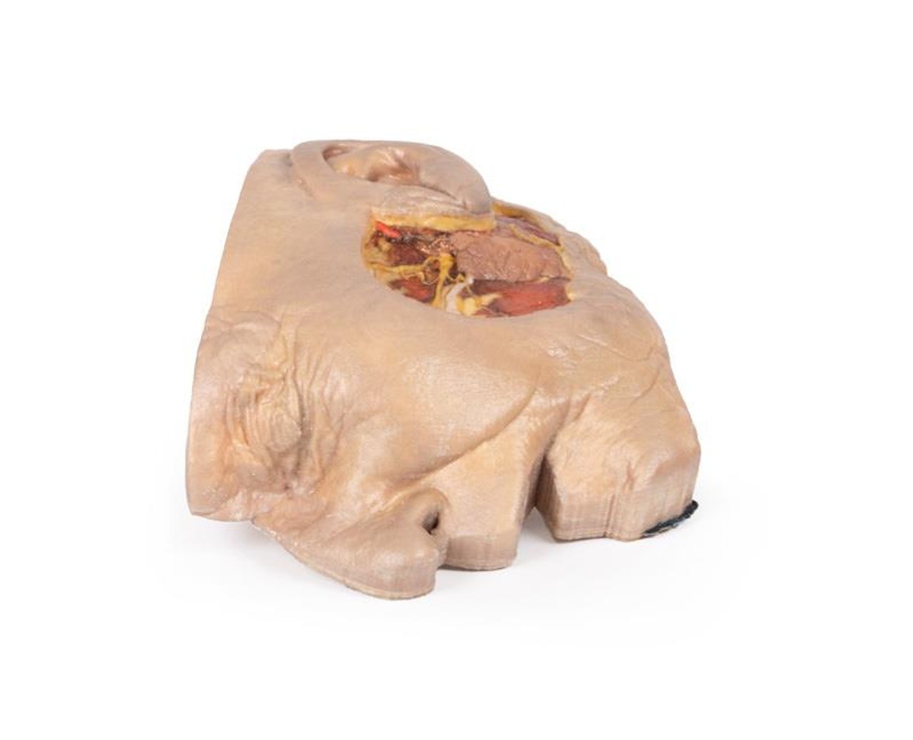 3D Printed Parotid Gland and Facial Nerve Dissection