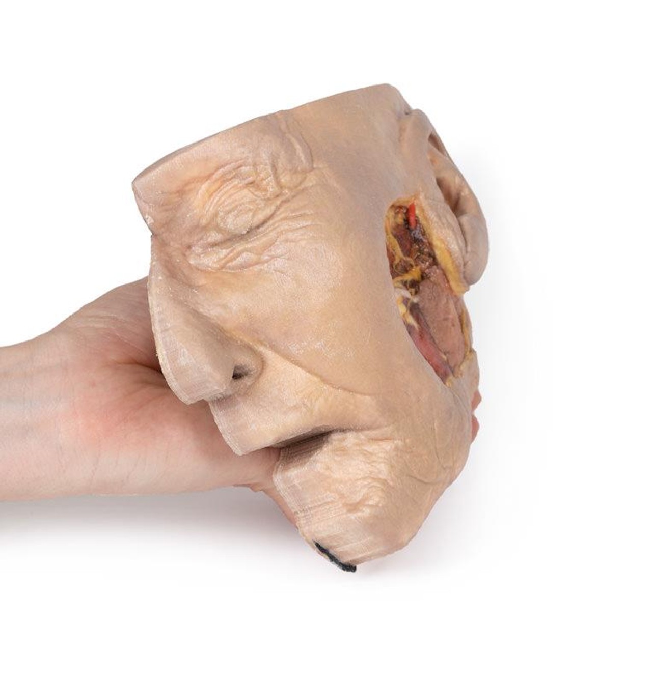 3D Printed Parotid Gland and Facial Nerve Dissection