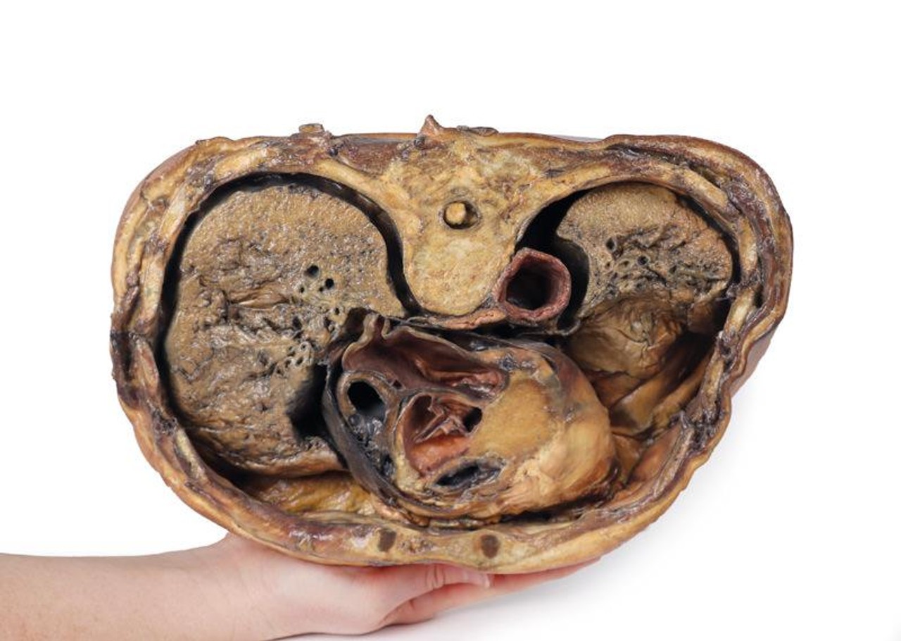 3D Printed Thoracic Cross Section At T6
