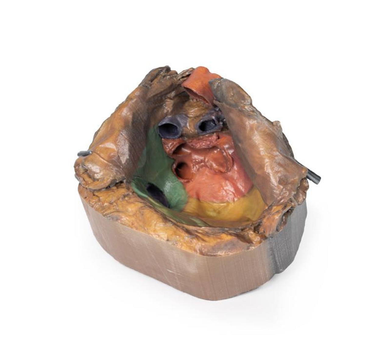 3D Printed Pericardial Space
