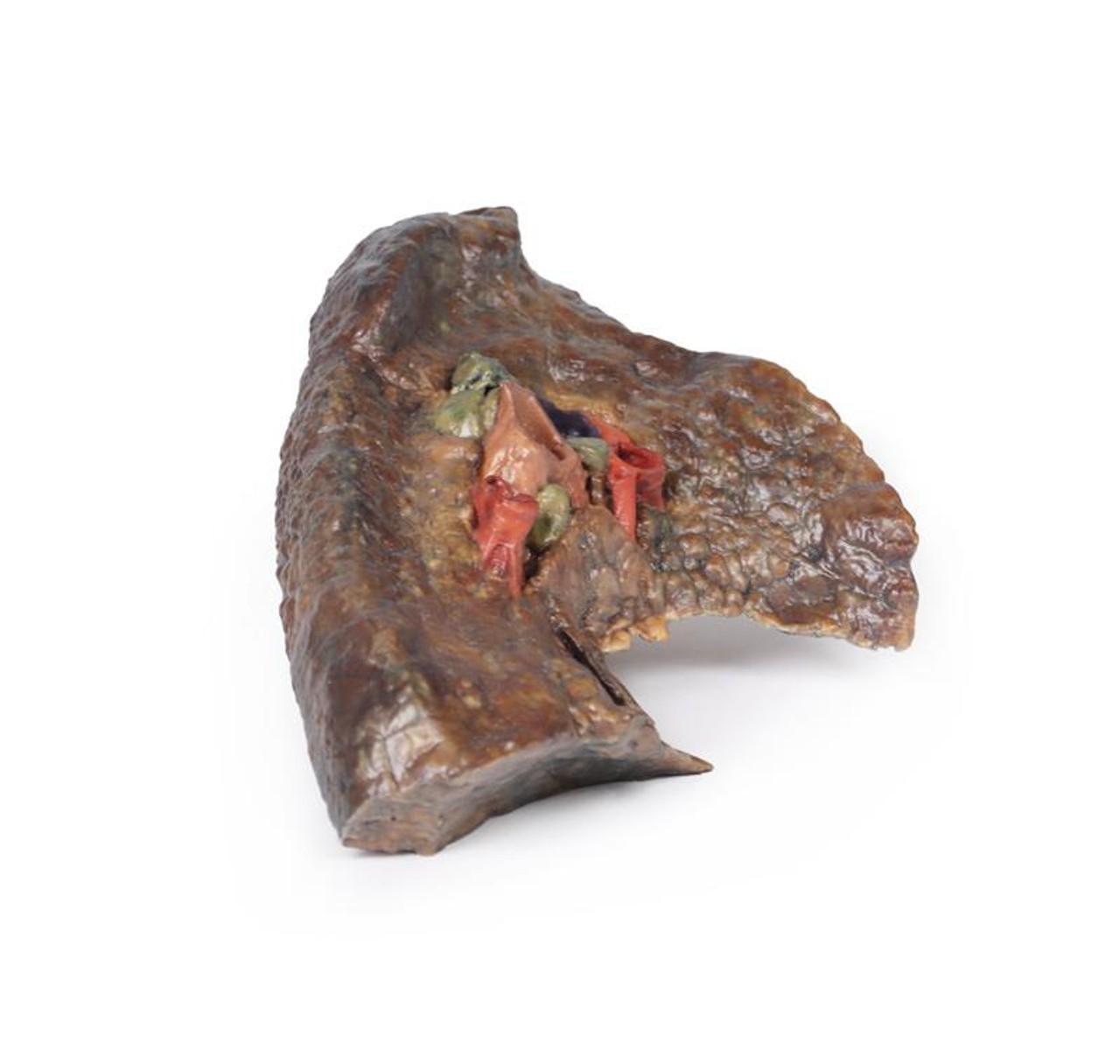 3D Printed Hilum of the Left Lung