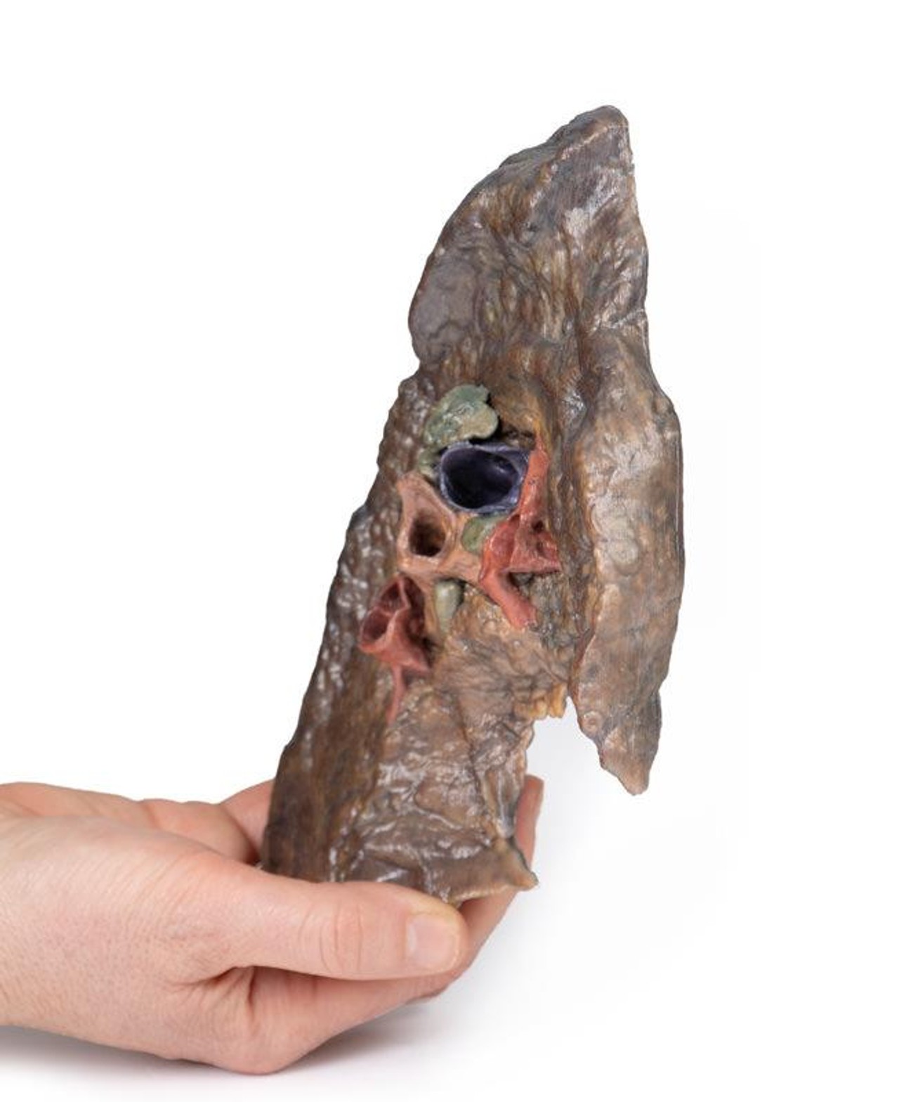 3D Printed Hilum of the Left Lung