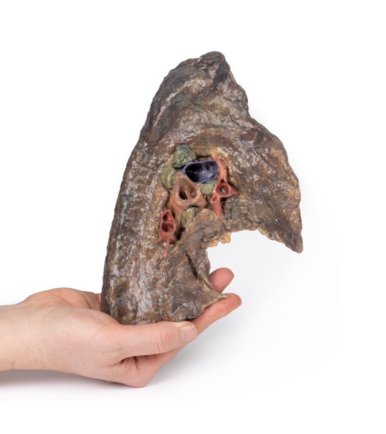 3D Printed Hilum of the Left Lung