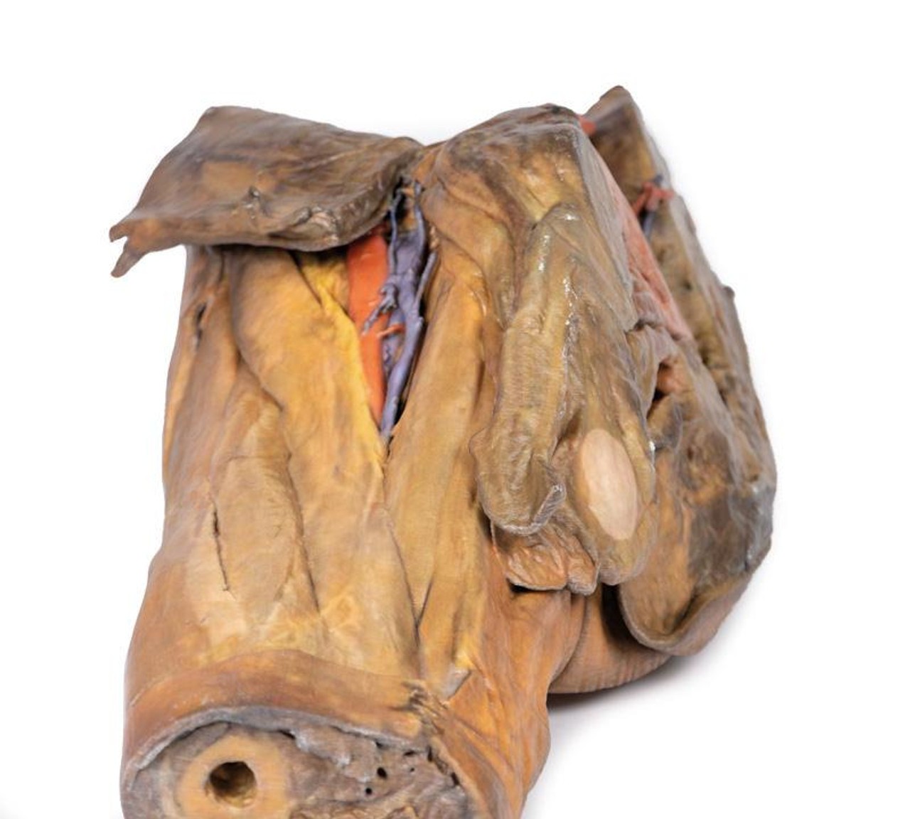 3D Printed Hilum of the Left Lung