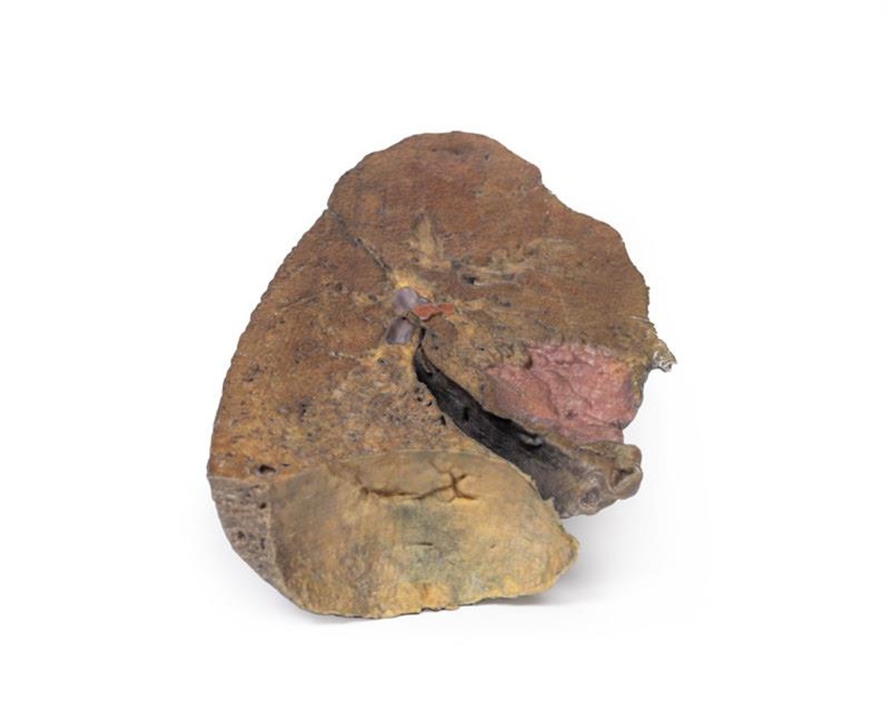3D Printed Lung Slab with Hilum Removed