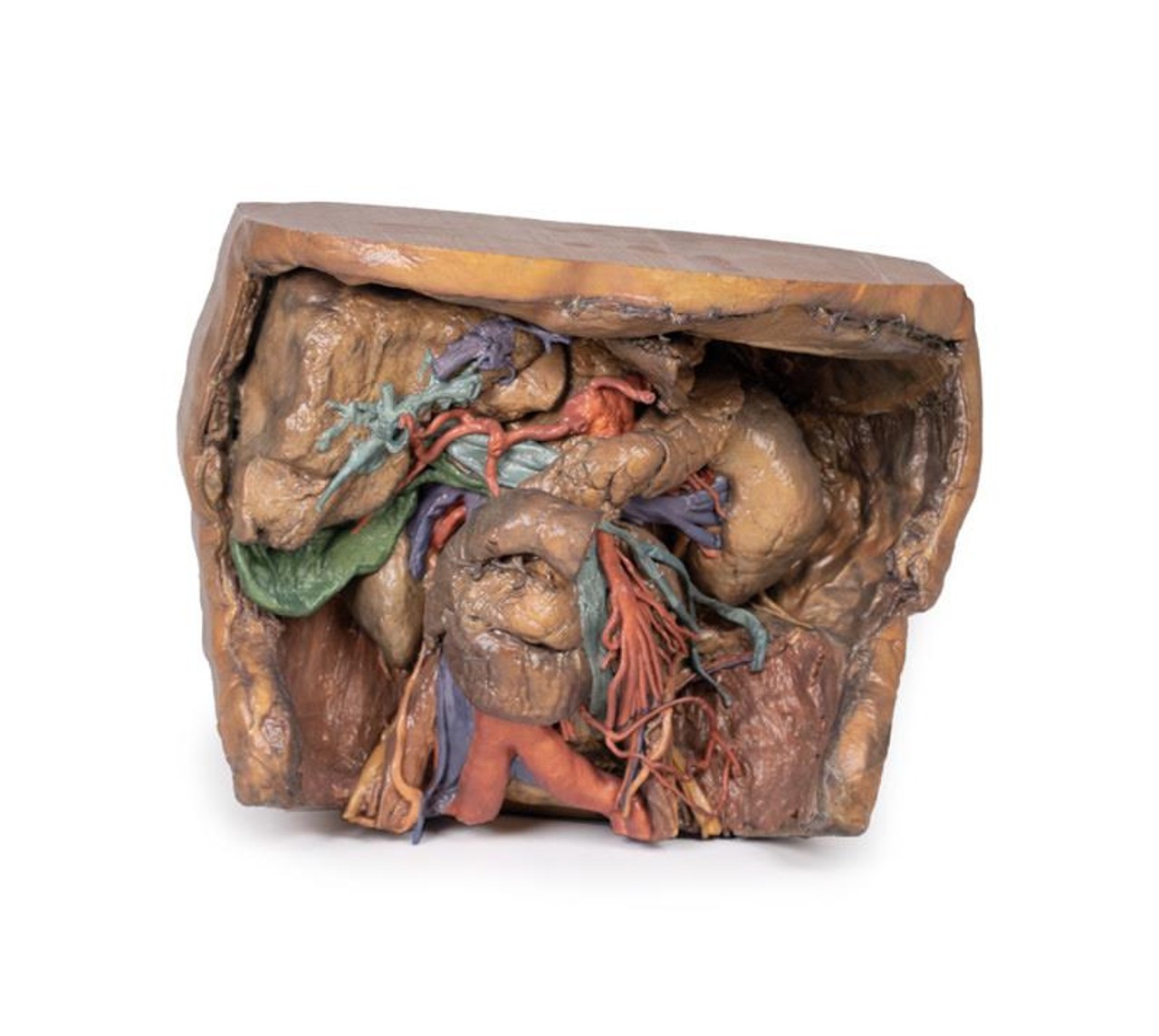 3D Printed Abdomen Vasculature