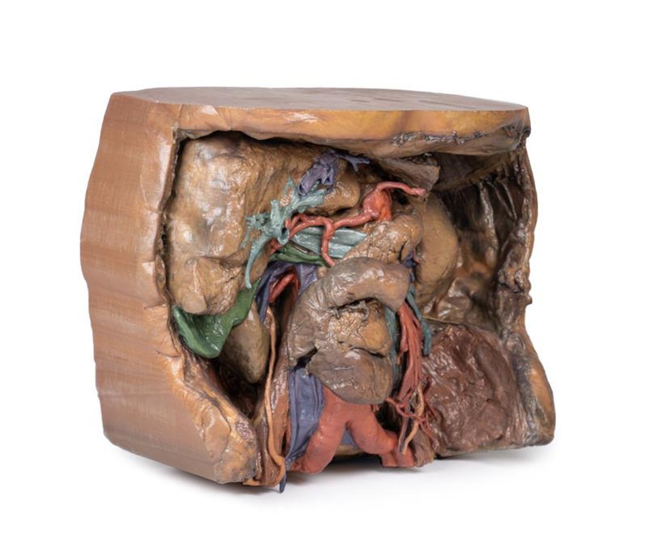 3D Printed Abdomen Vasculature