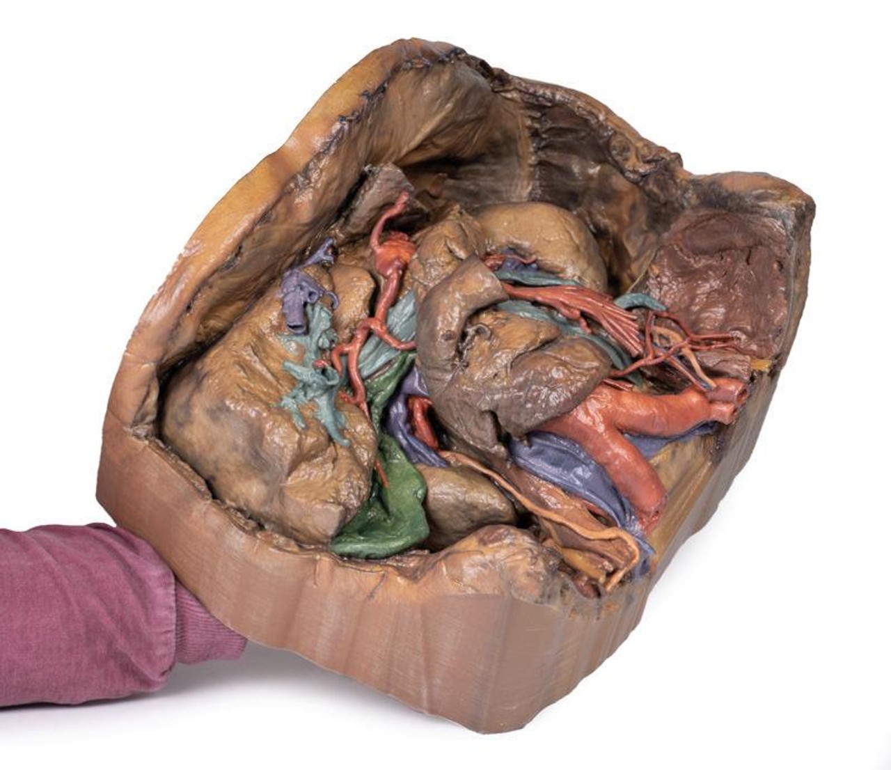 3D Printed Abdomen Vasculature