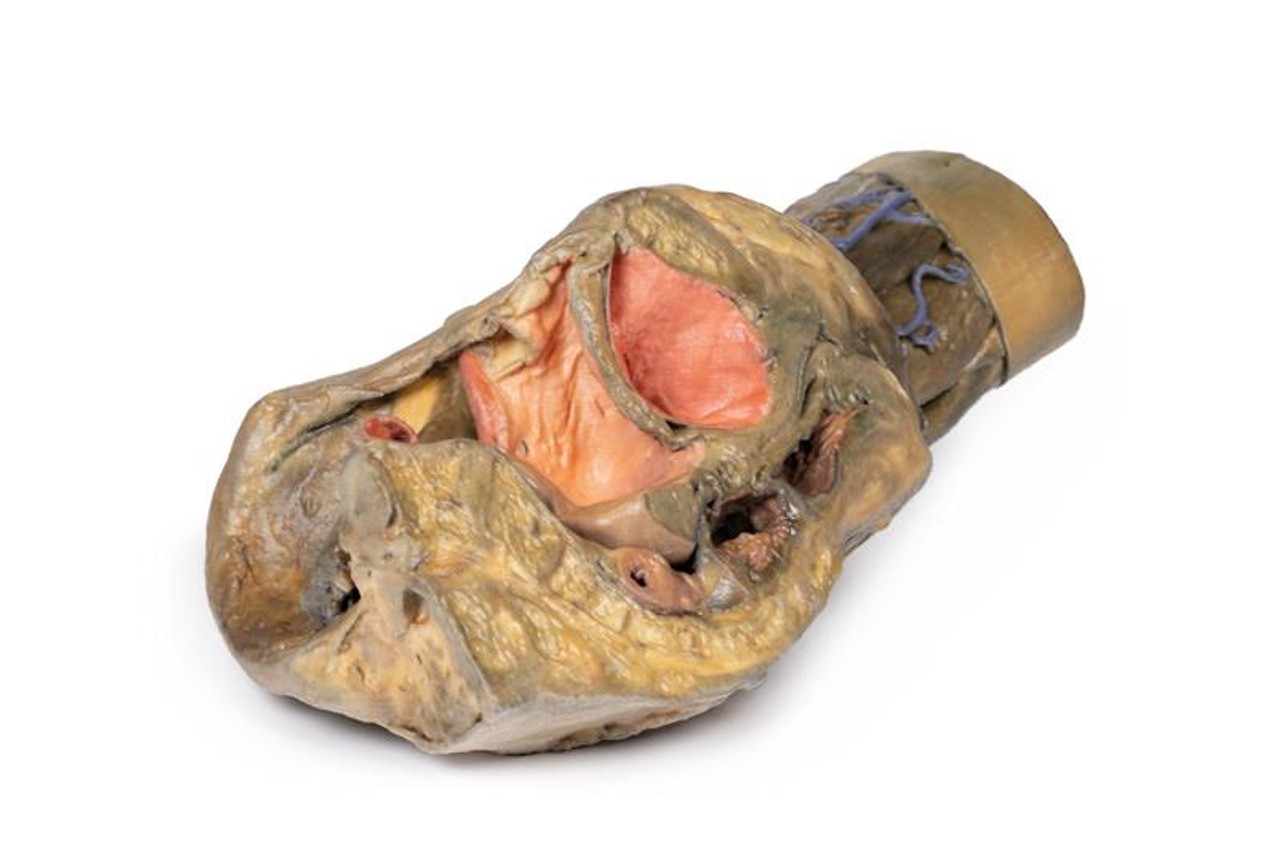 3D Printed Female Hemipelvis and Thigh