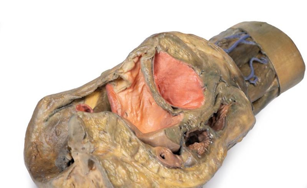3D Printed Female Hemipelvis and Thigh