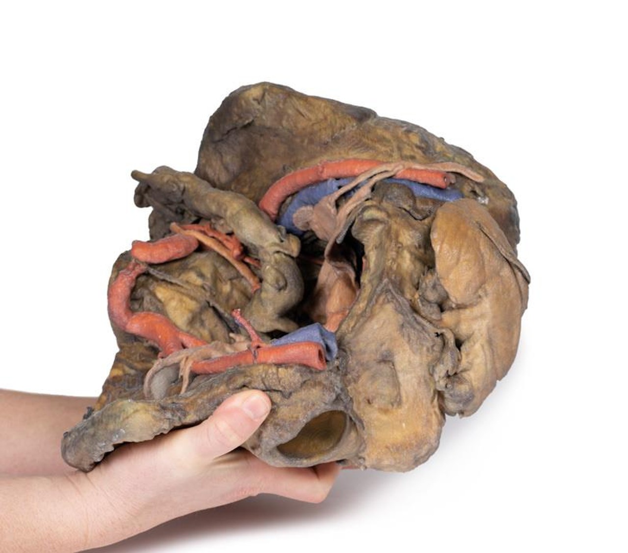 3D Printed Female Pelvis Deep Dissection