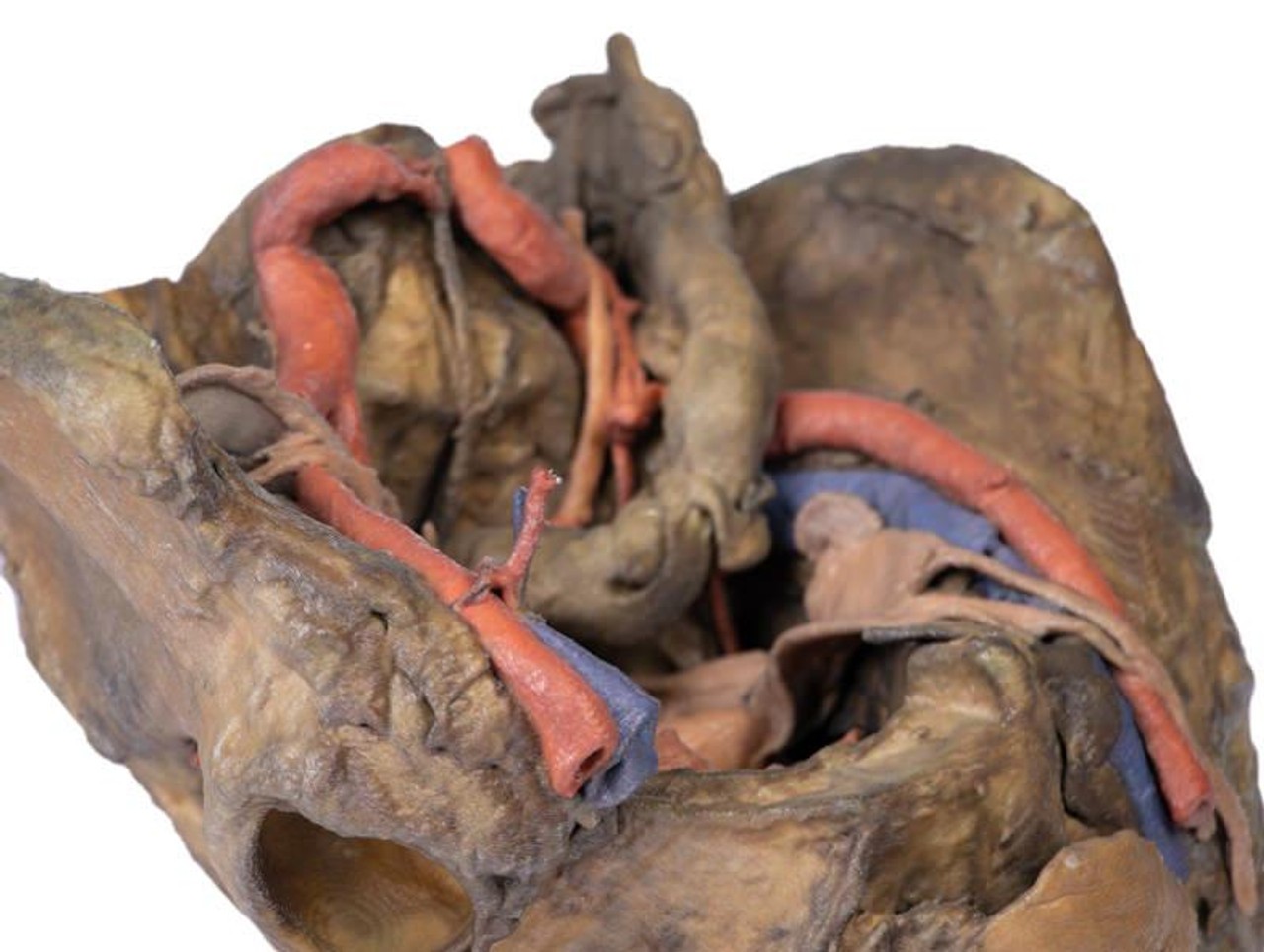3D Printed Female Pelvis Deep Dissection