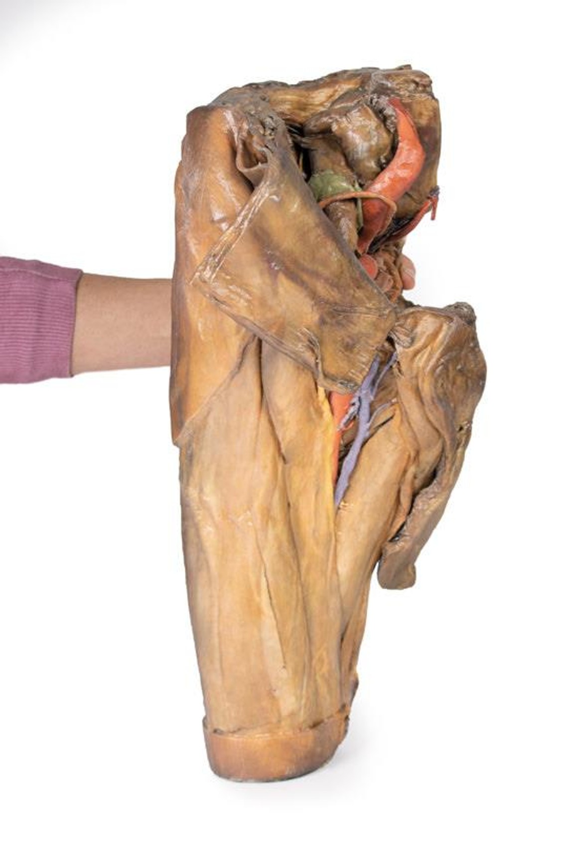 3D Printed Male Hemipelvis and Thigh