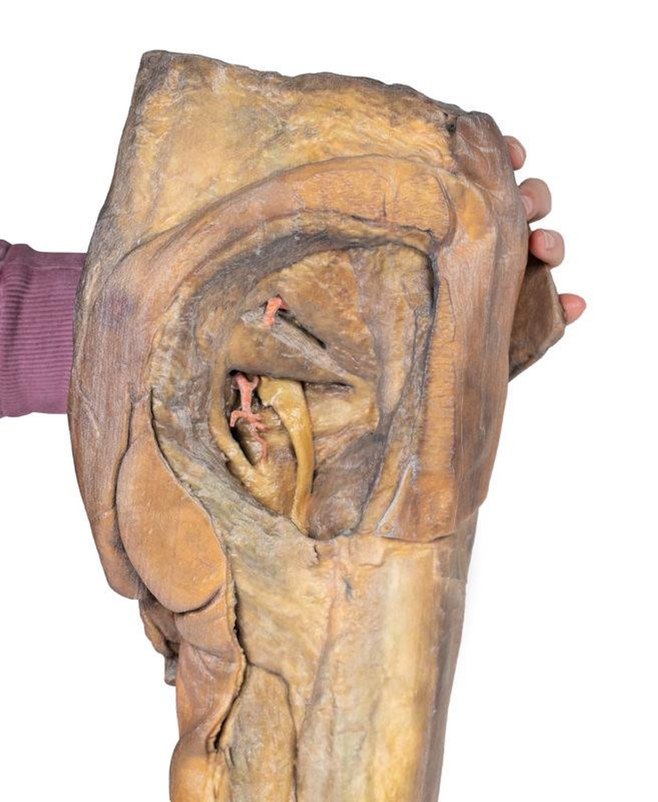 3D Printed Male Hemipelvis and Thigh