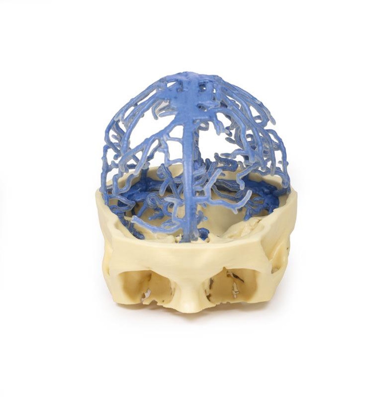 3D Printed Venous Circulation of the Brain