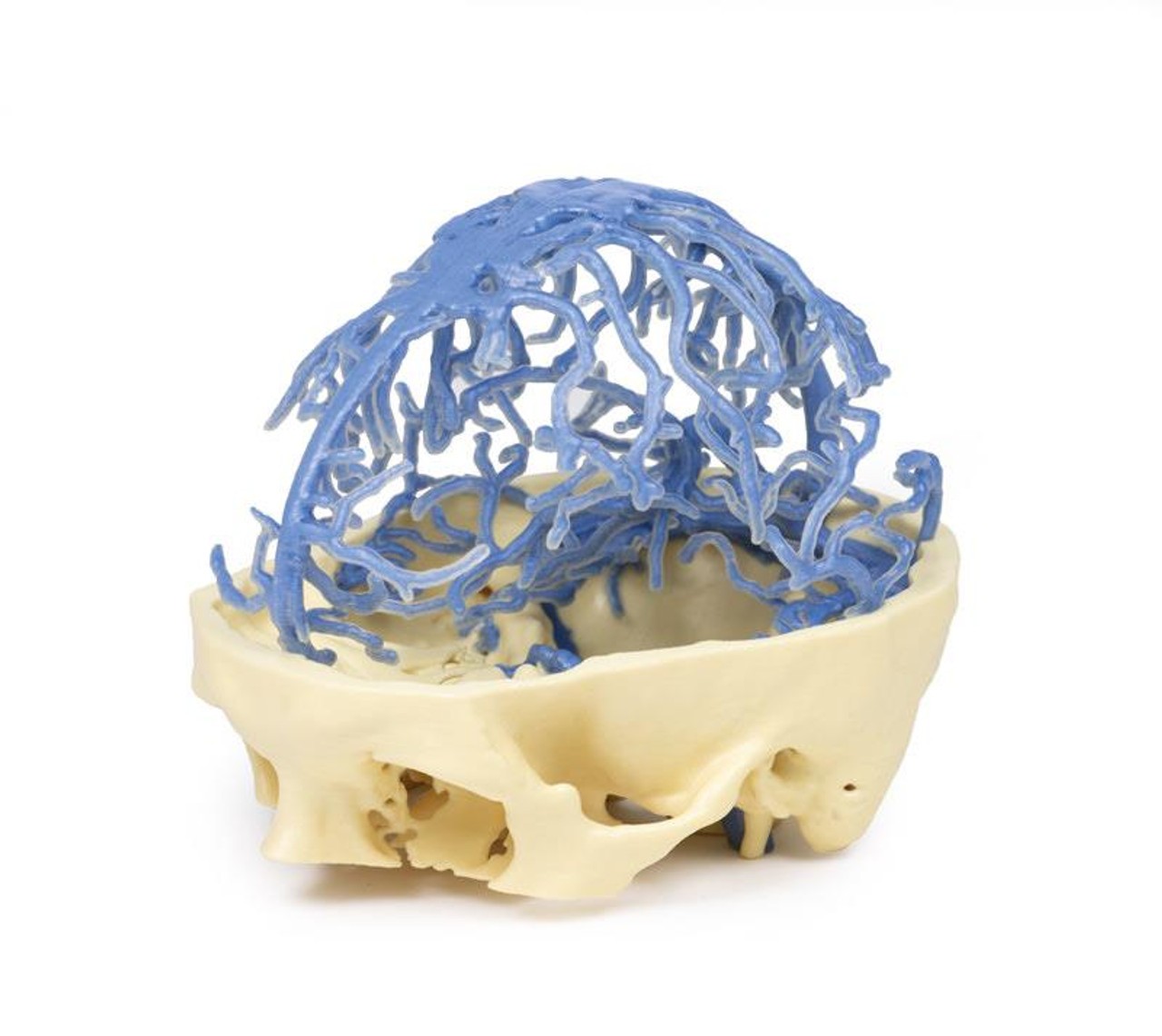 3D Printed Venous Circulation of the Brain
