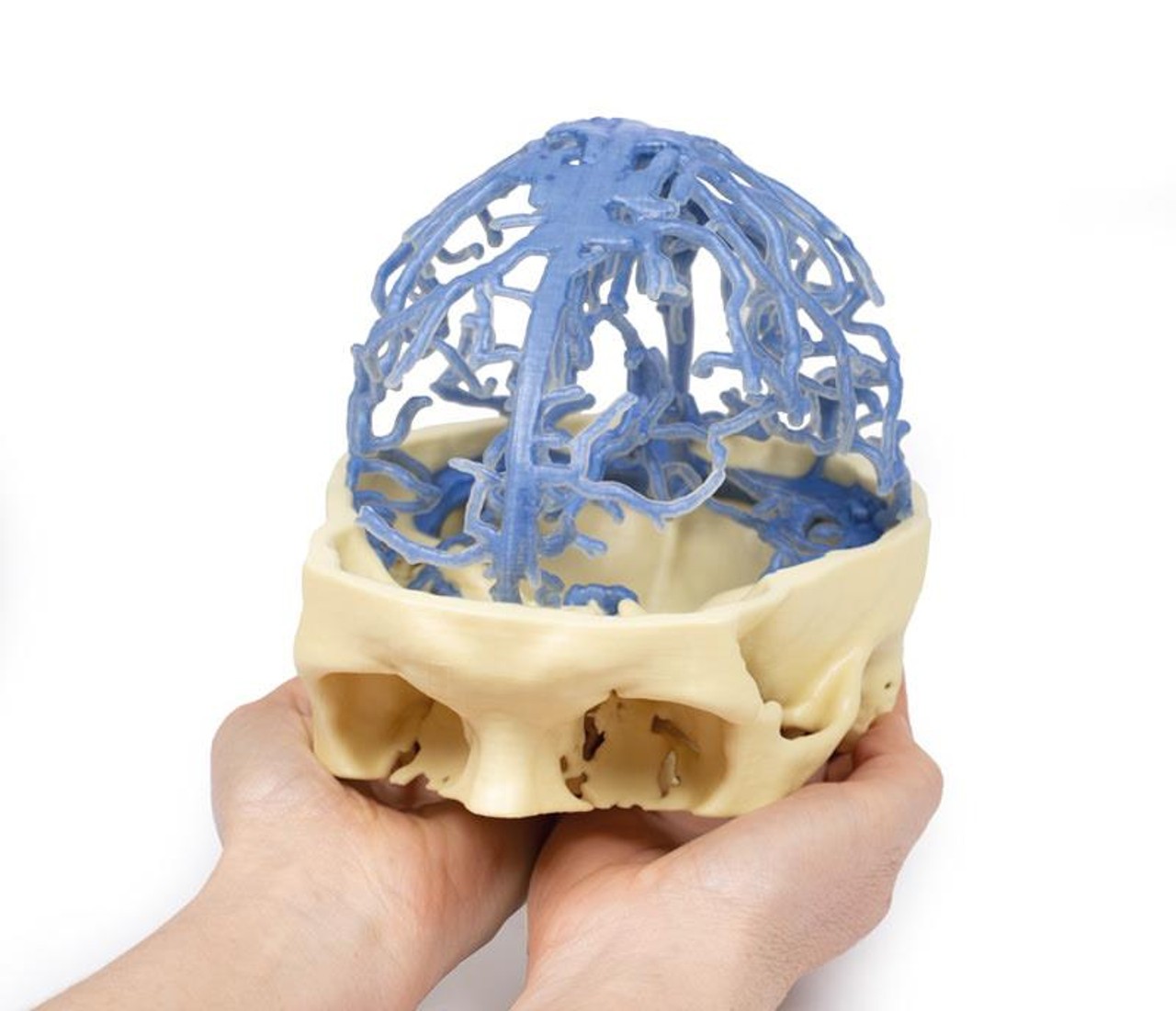 3D Printed Venous Circulation of the Brain