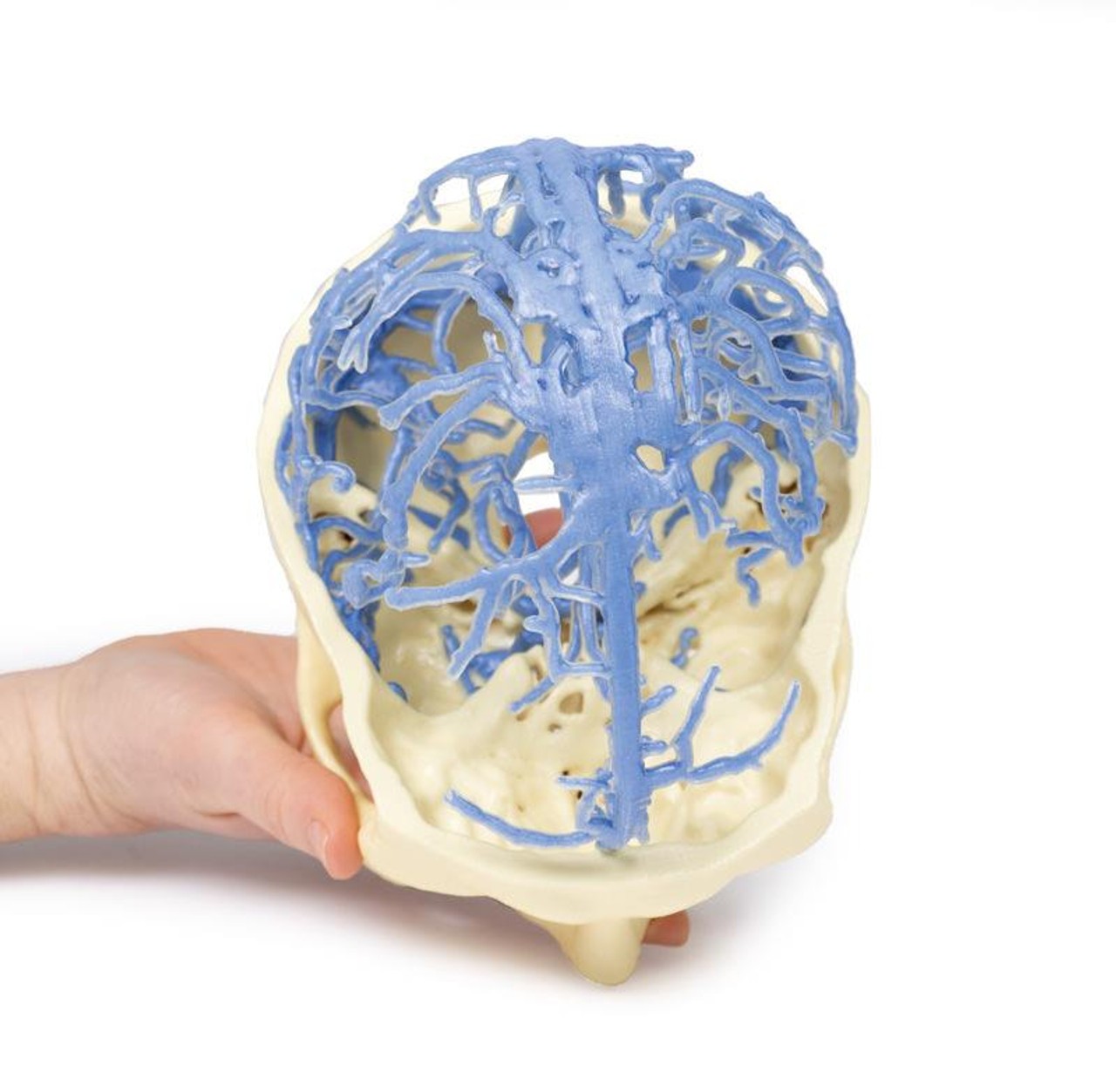 3D Printed Venous Circulation of the Brain