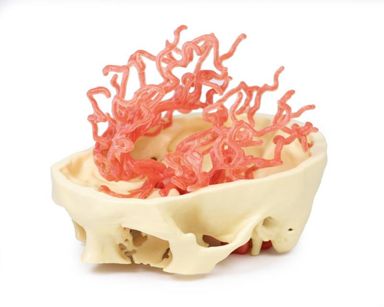 3D Printed Arterial Circulation of the Brain