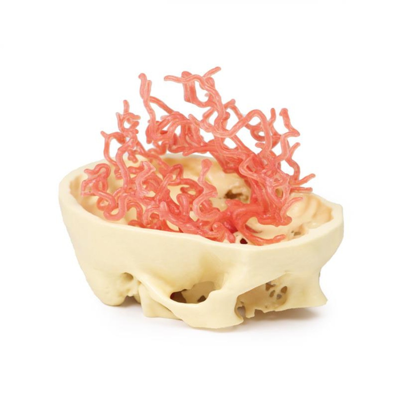 3D Printed Arterial Circulation of the Brain