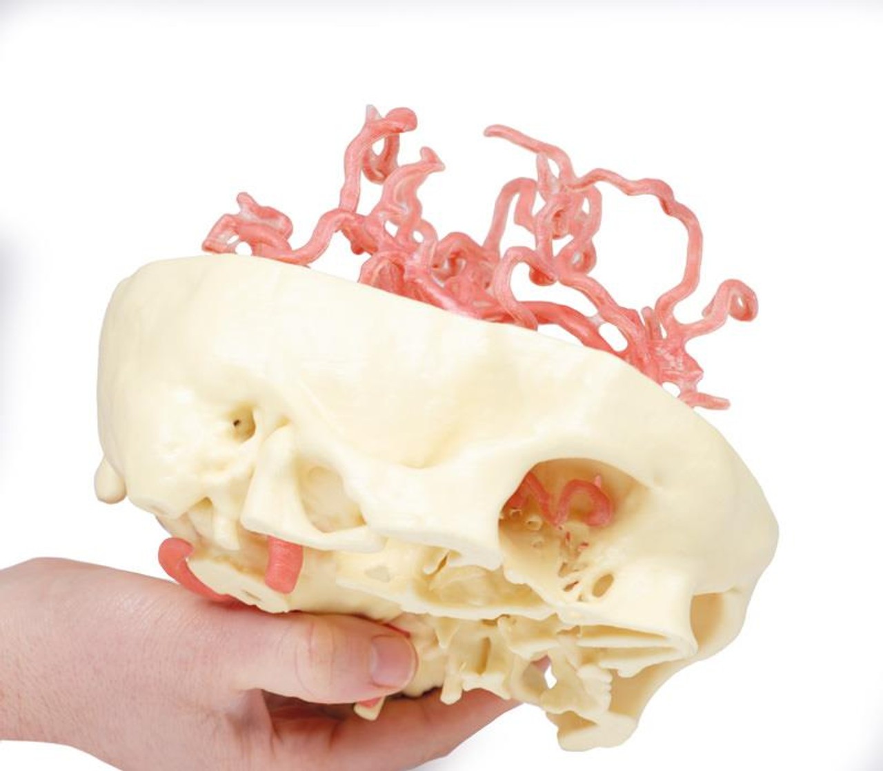 3D Printed Arterial Circulation of the Brain