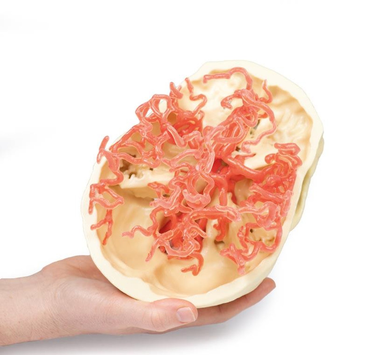3D Printed Arterial Circulation of the Brain