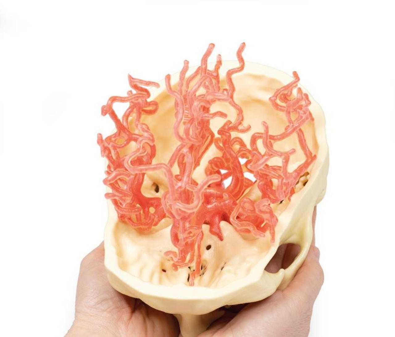3D Printed Arterial Circulation of the Brain