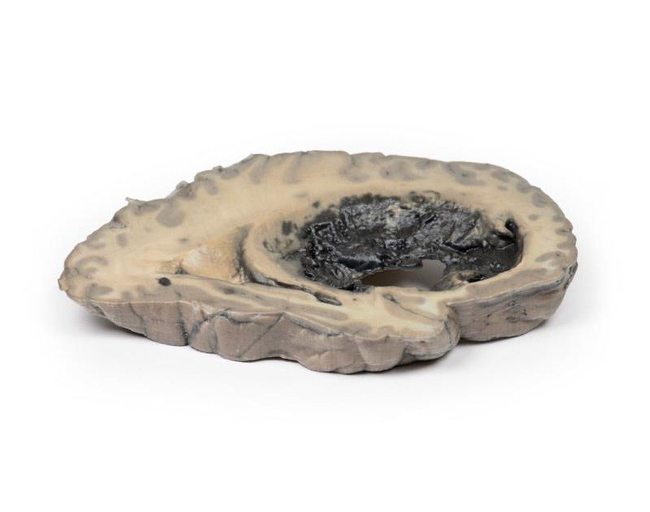 3D Printed Cerebral Haemorrhage