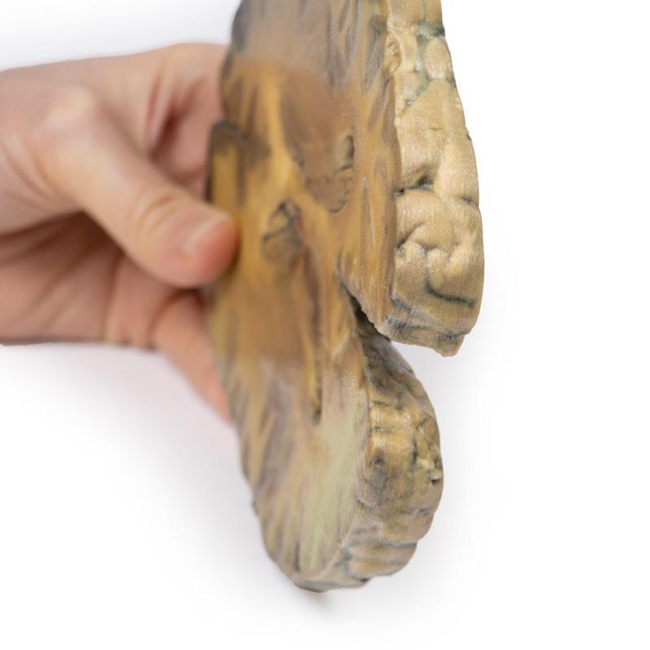 3D Printed Ventriculitis, Secondary to Septicaemia