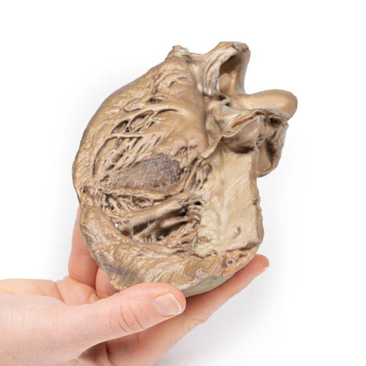 3D Printed Bicuspid Aortic Valve