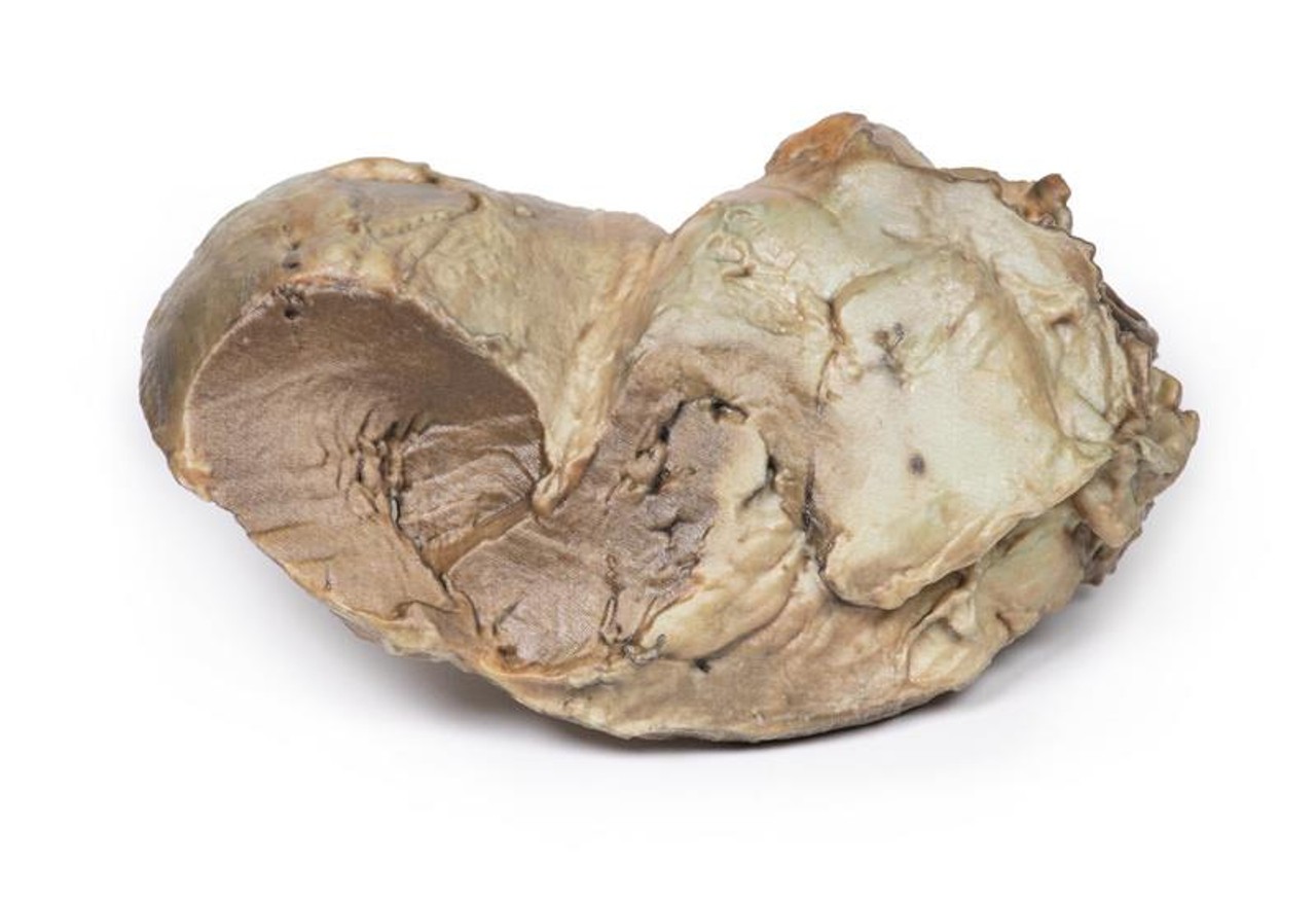 3D Printed Bicuspid Aortic Valve