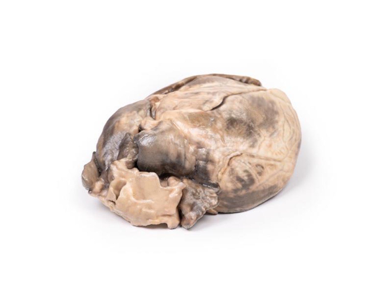 3D Printed Hypertrophic Subaortic Stenosis