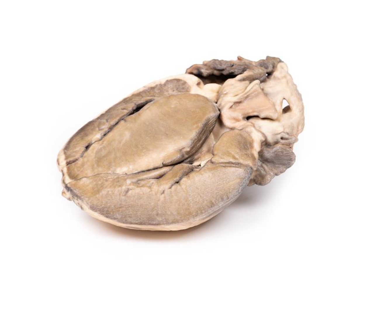 3D Printed Hypertrophic Subaortic Stenosis