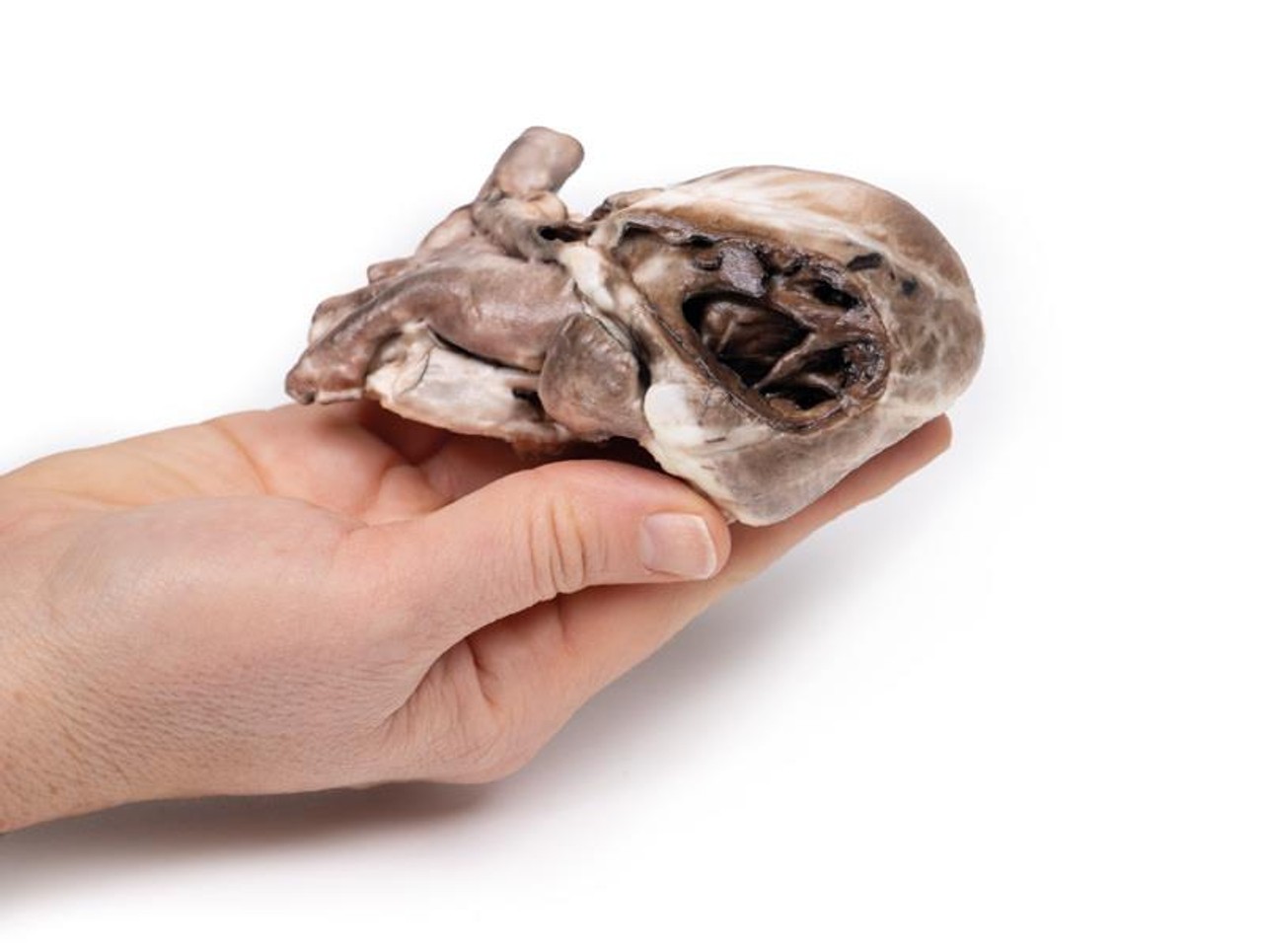 3D Printed Tetralogy of Fallot