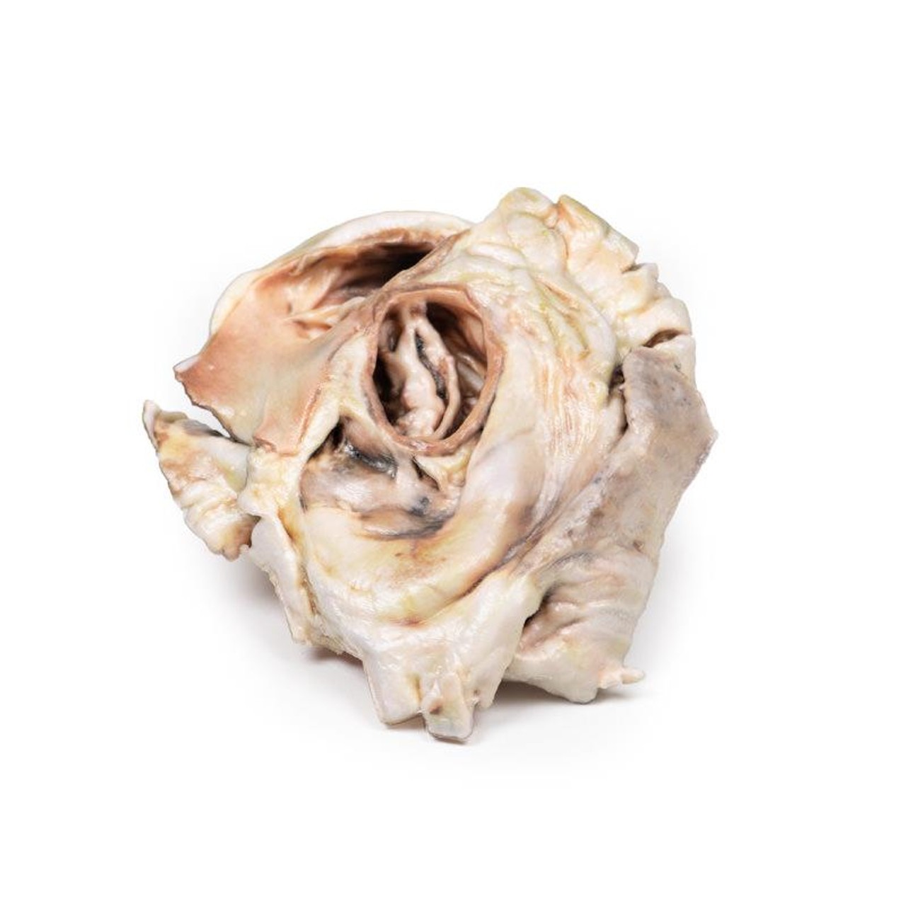 3D Printed Calcified Aortic Valvular Stenosis Bicuspid Aortic Valve