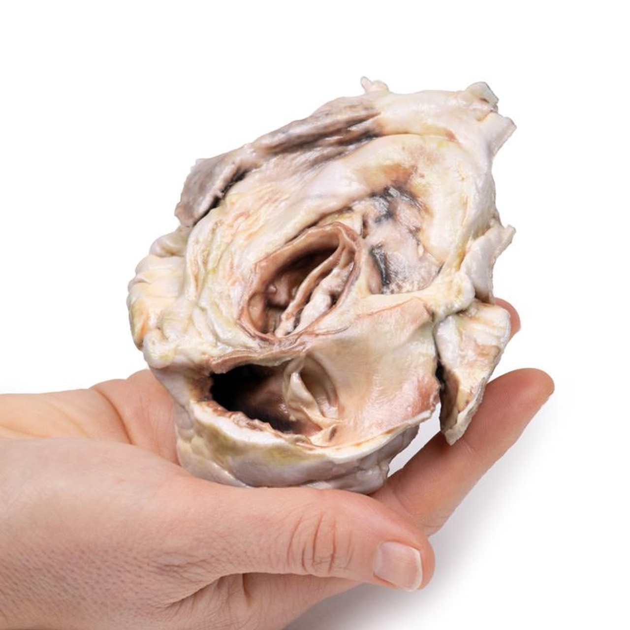 3D Printed Calcified Aortic Valvular Stenosis Bicuspid Aortic Valve