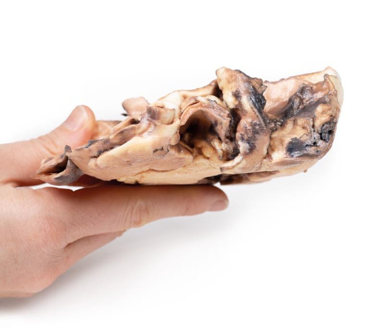 3D Printed Rheumatic Endocarditis