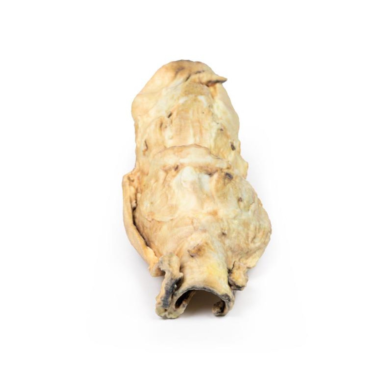 3D Printed Carcinoma of Larynx