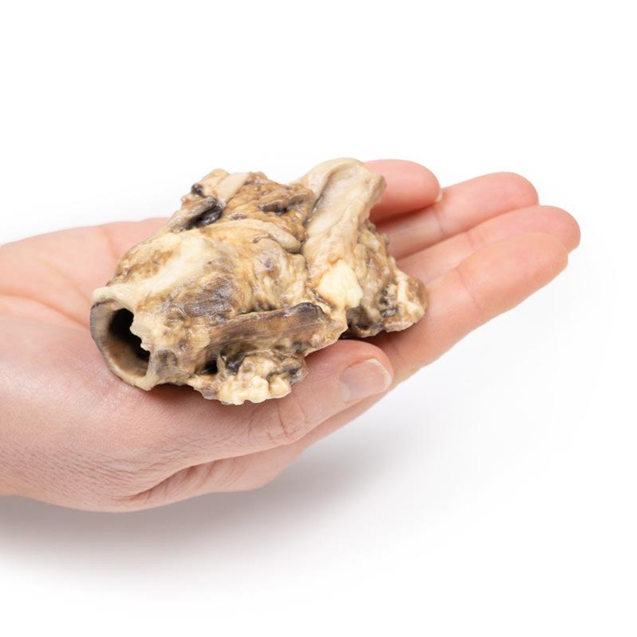 3D Printed Carcinoma of Pyriform Fossa