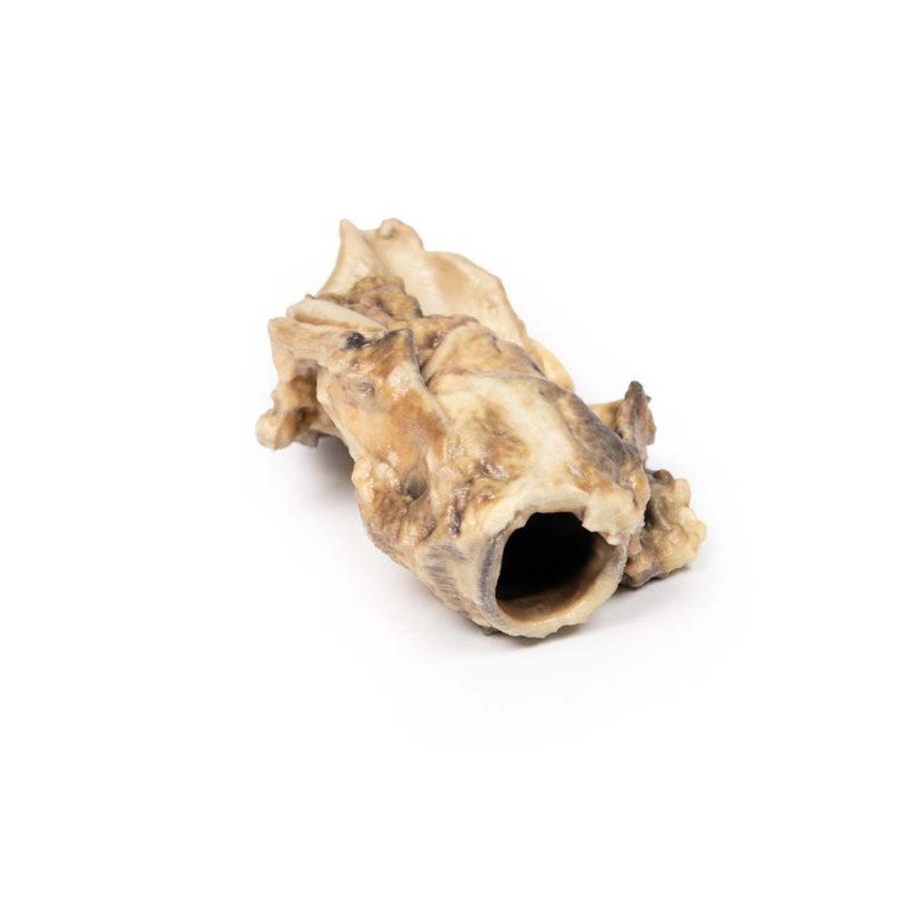 3D Printed Carcinoma of Pyriform Fossa
