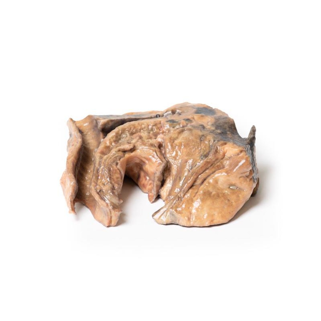 3D Printed Inhaled Foreign Body in the Trachea