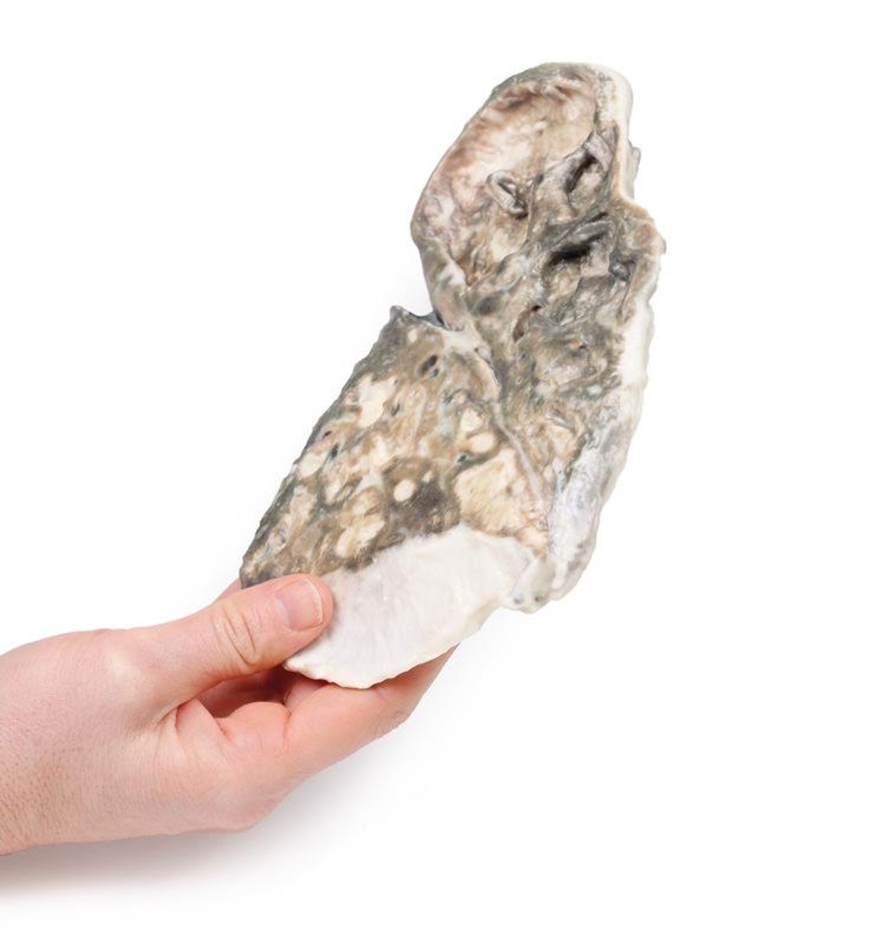 3D Printed Fibrocaseous Tuberculosis