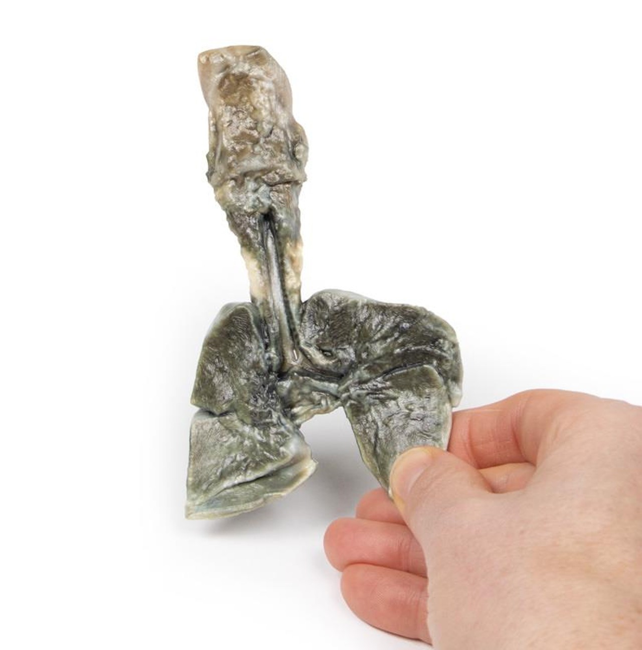 3D Printed Tracheoesophageal Fistula and Oesophagus Atresia