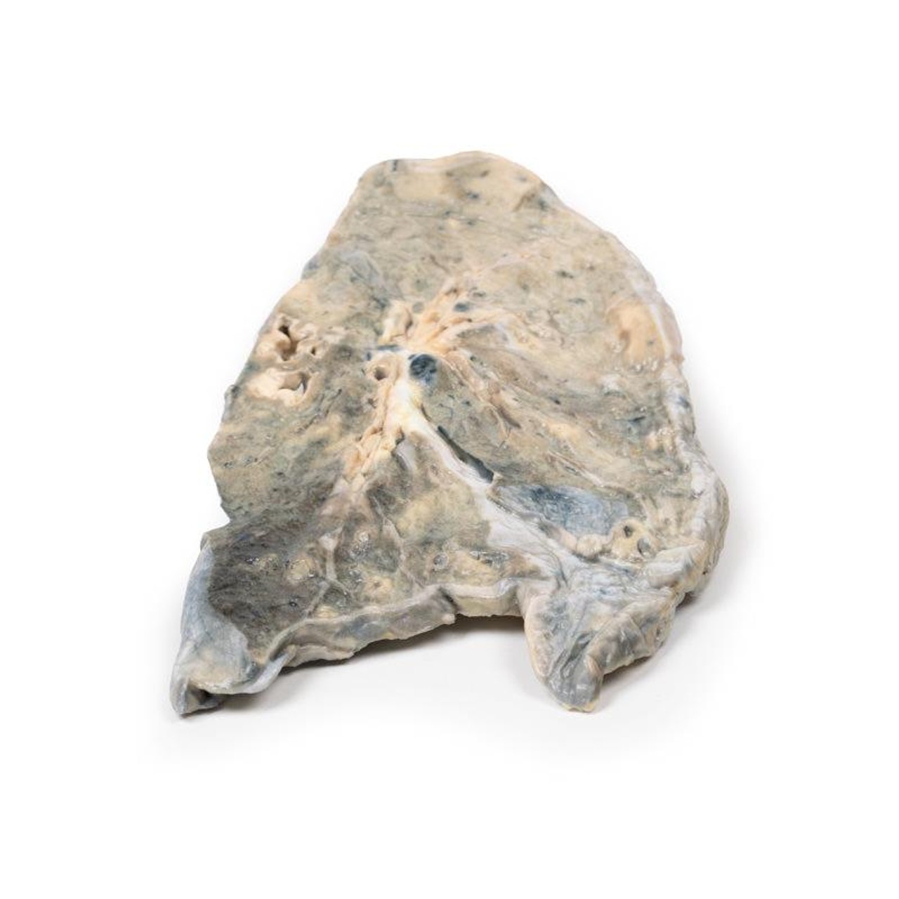 3D Printed Staphylococcus Aureus Abscesses in the Lung