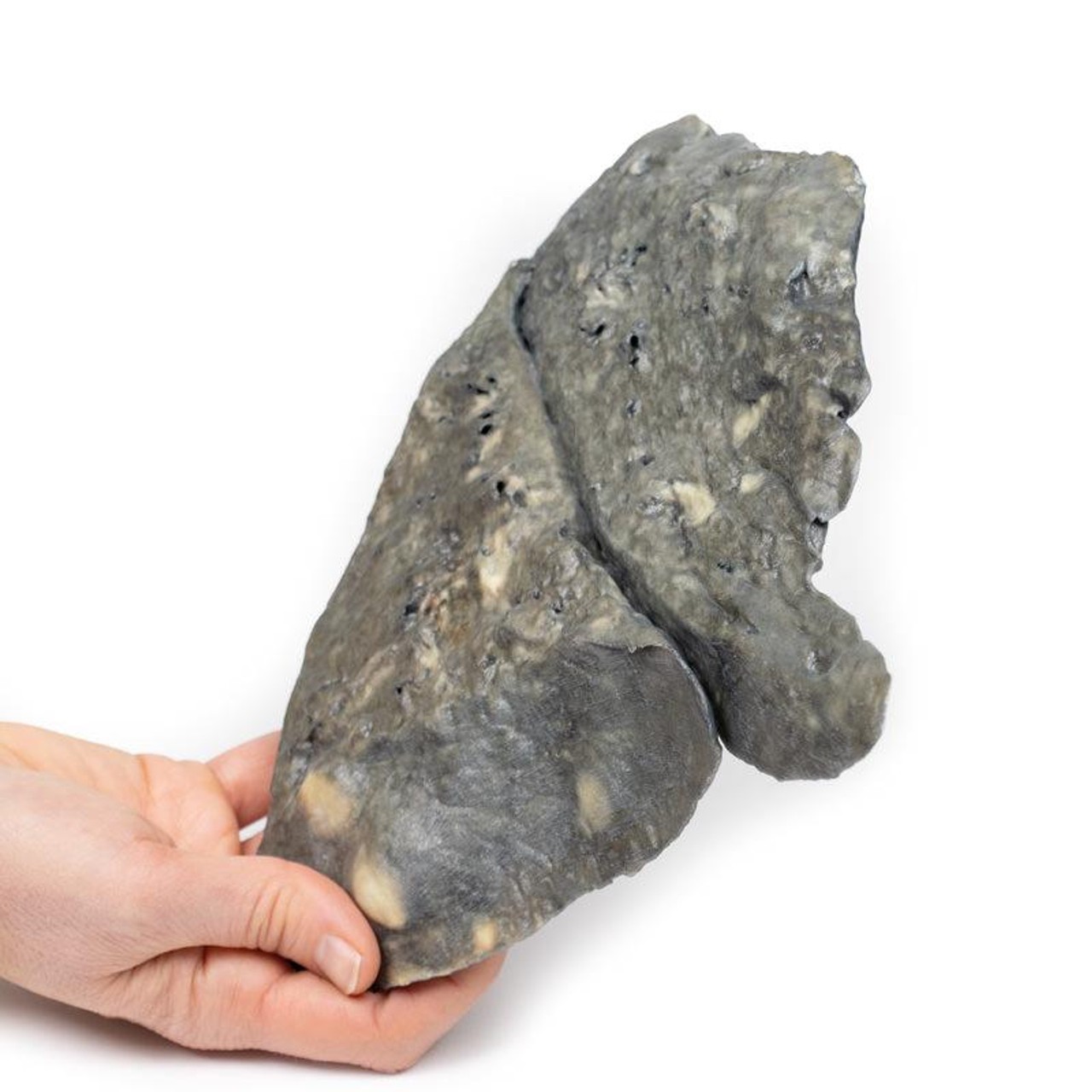 3D Printed Multiple Secondary Carcinoma Deposits in the Lung and Pleura