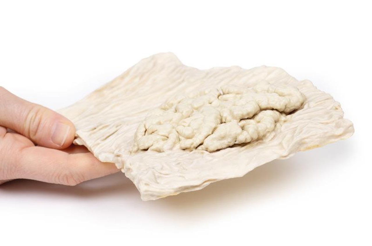 3D Printed Villous Adenoma of Colon
